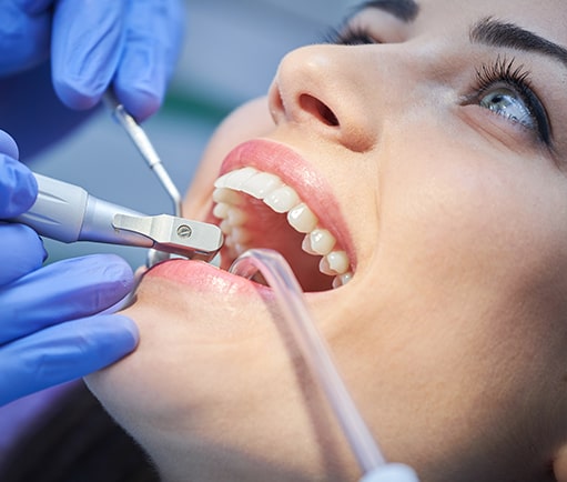 Exceptional dental care BR Dental DentalBondingpage improve appearance